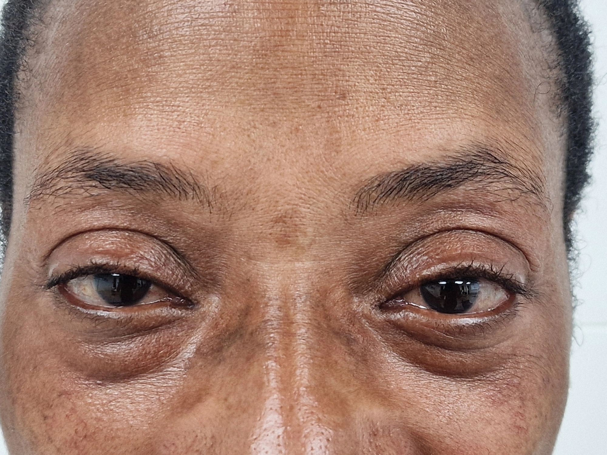 Brow case 02: natural brows before treatment