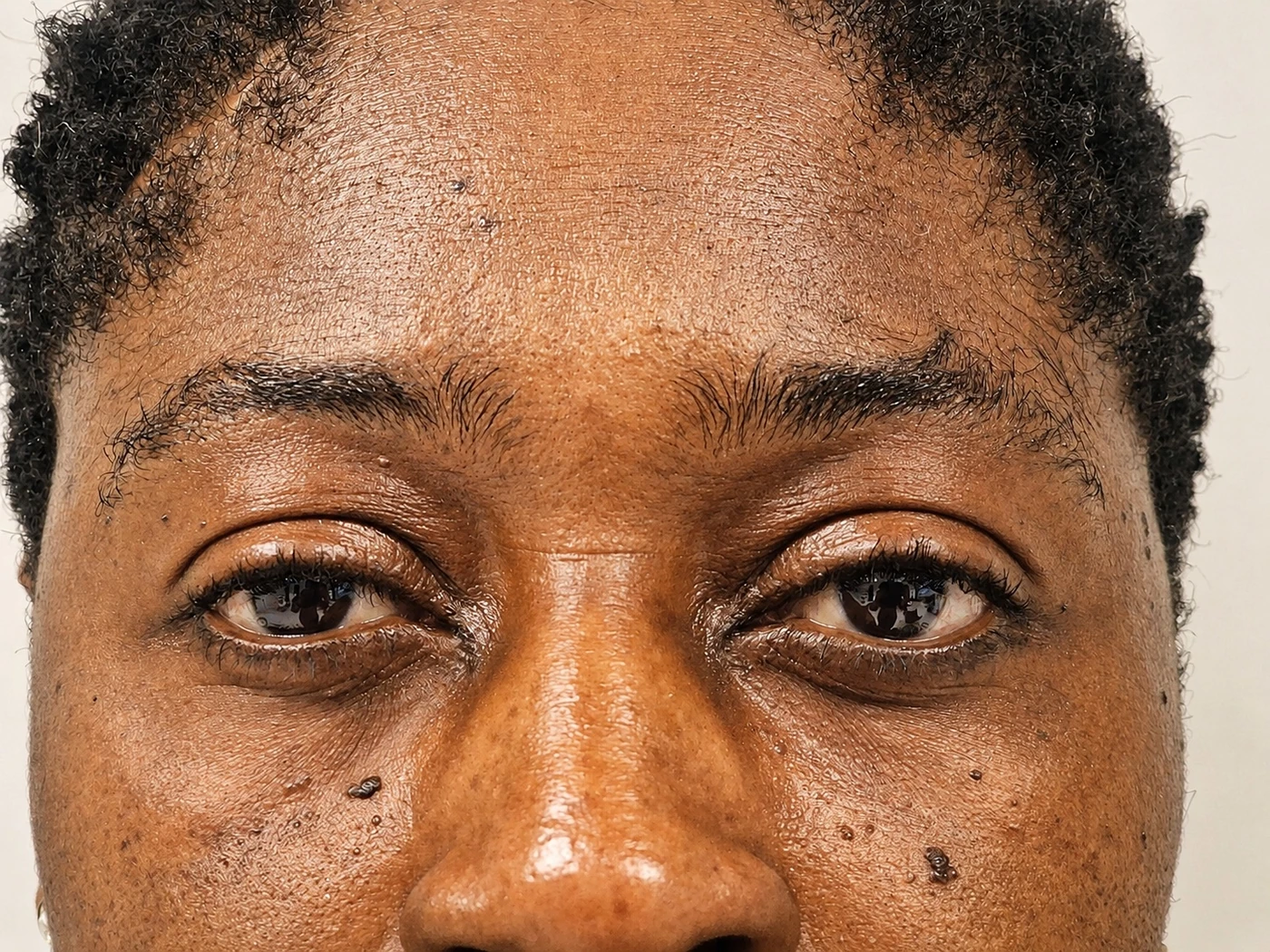 Brow case 06: natural brows before treatment