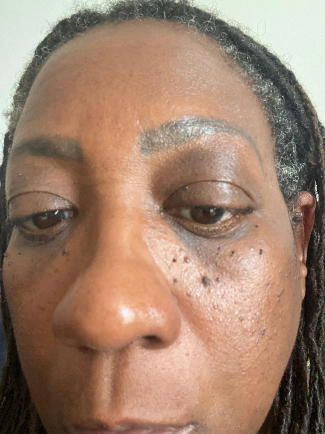 DPN case 02: photograph labelled before treatment