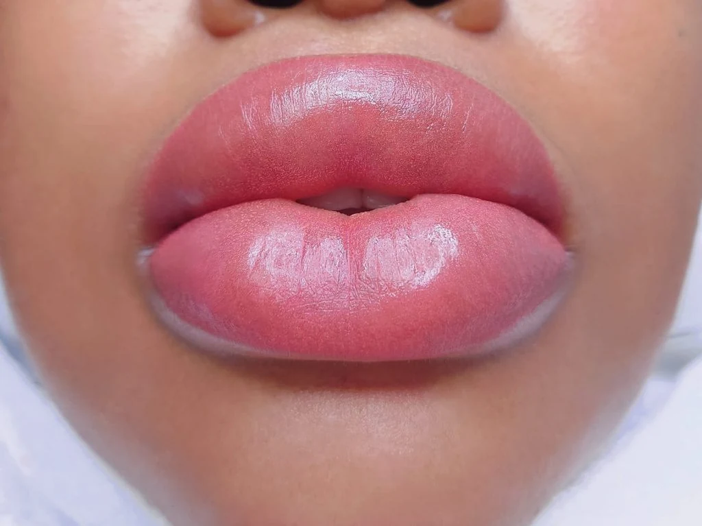 Another lip blush treatment photograph from WOB’s gallery