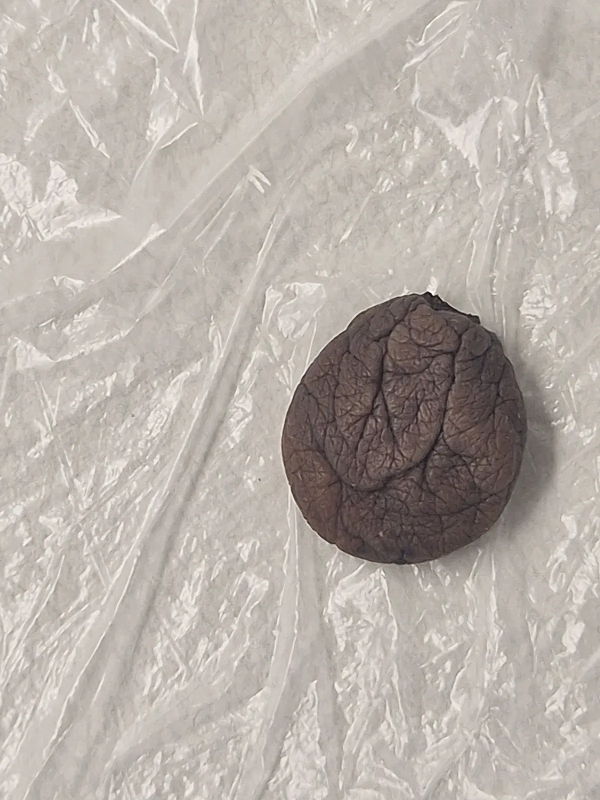 The removed skin tag on a drape, not the treated skin