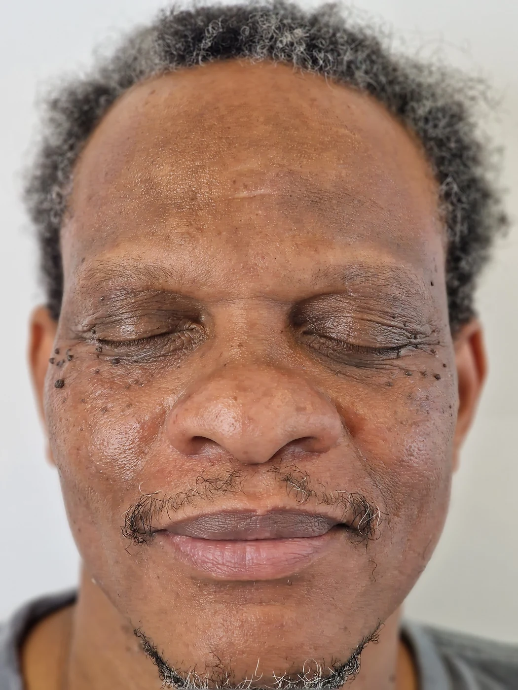 Individual photograph supplied in the Skin tags folder